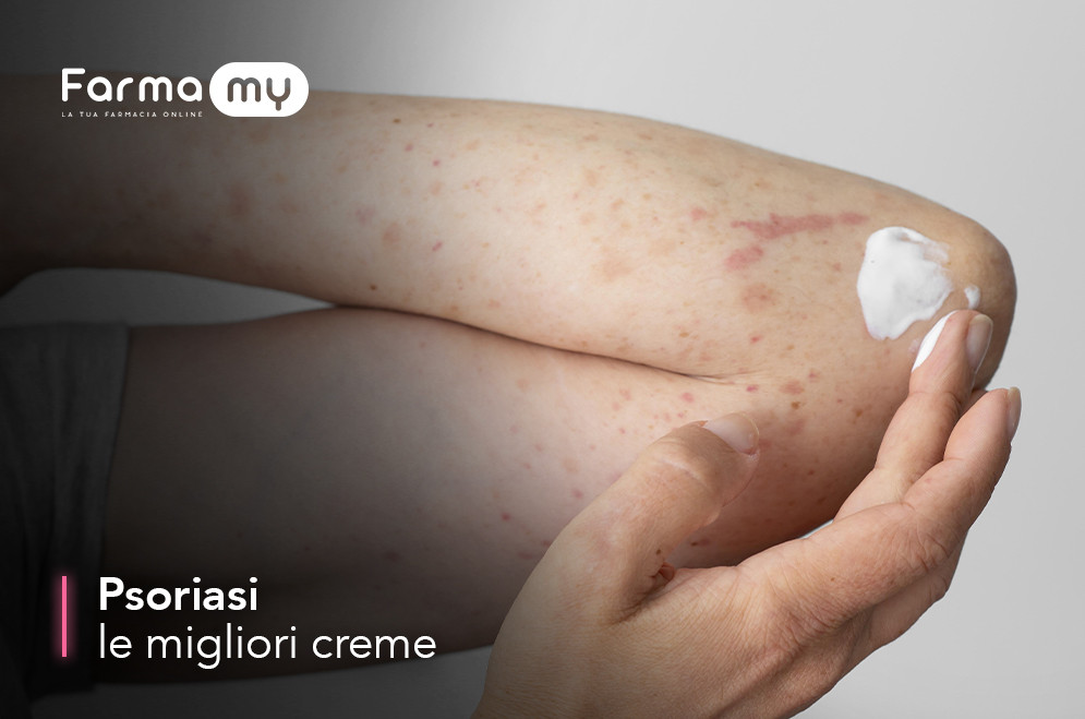 Le migliori creme per la Psoriasi